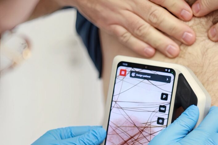 Komplexná diagnostika kožných ochorení